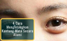 Cara Menghilangkan Kantung Mata