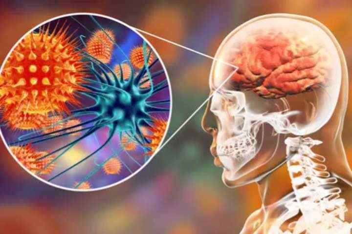 Penyakit Meningitis